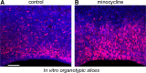 Figure 11.