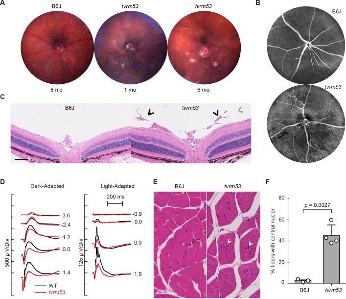 Fig 10