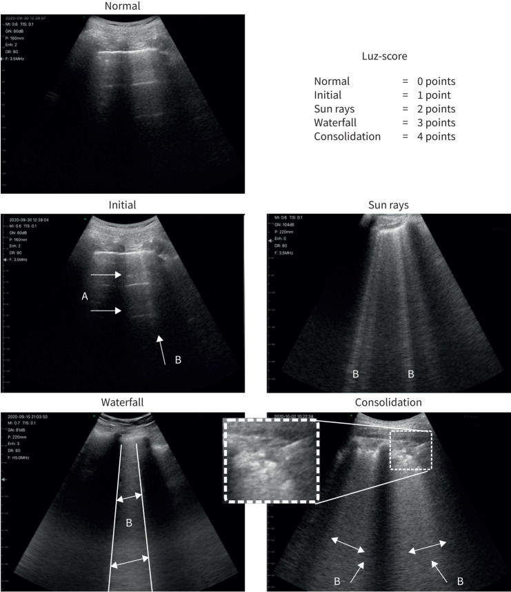 FIGURE 1