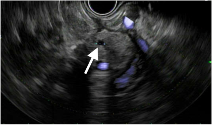 Figure 4