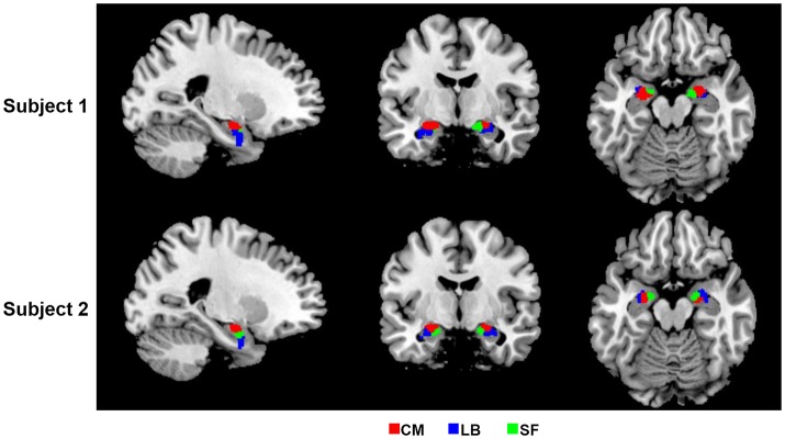 Figure 2