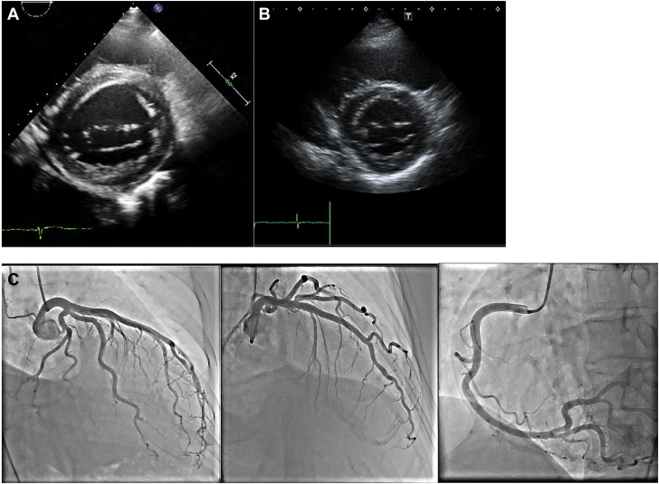 Figure 2