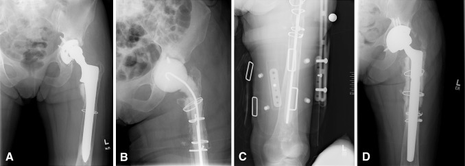 Fig. 1A–D