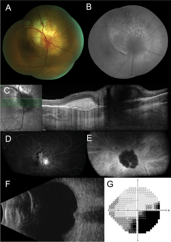 Fig. 1