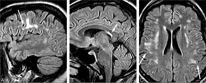 Fig 6.