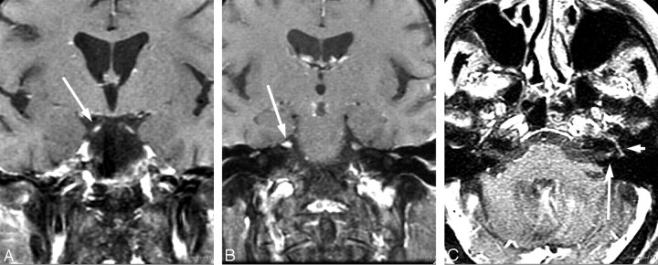 Fig 5.