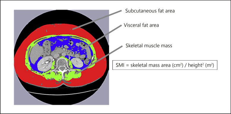 Fig. 2