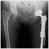 Fig. (11)