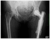 Fig. (10)