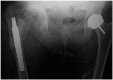 Fig. (4)
