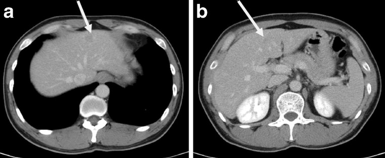 Fig.
                            1