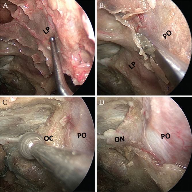 Fig. 3