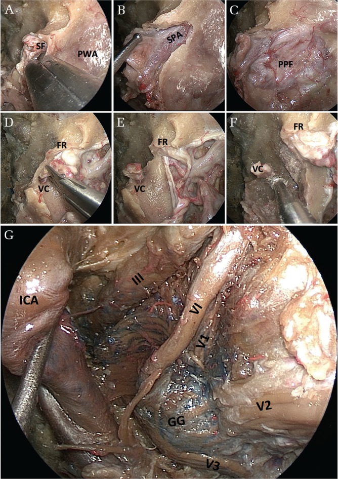 Fig. 4