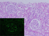 <underline><b>Fig. 3</b></underline>