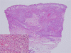 <underline><b>Fig. 2</b></underline>