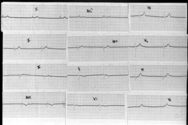 Figure 1  