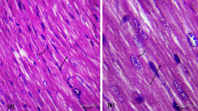 Fig. 11