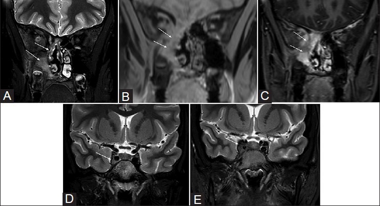 Figure 2(A-E)