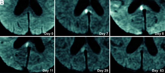 FIG 2.