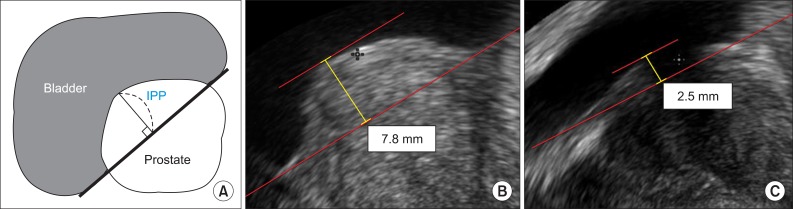 FIG. 1