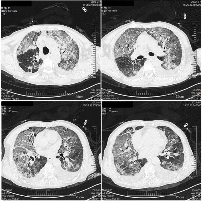 Figure 3