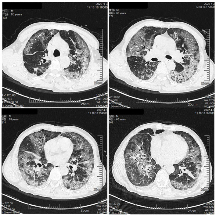 Figure 2