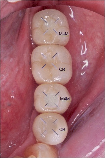 Fig. 4