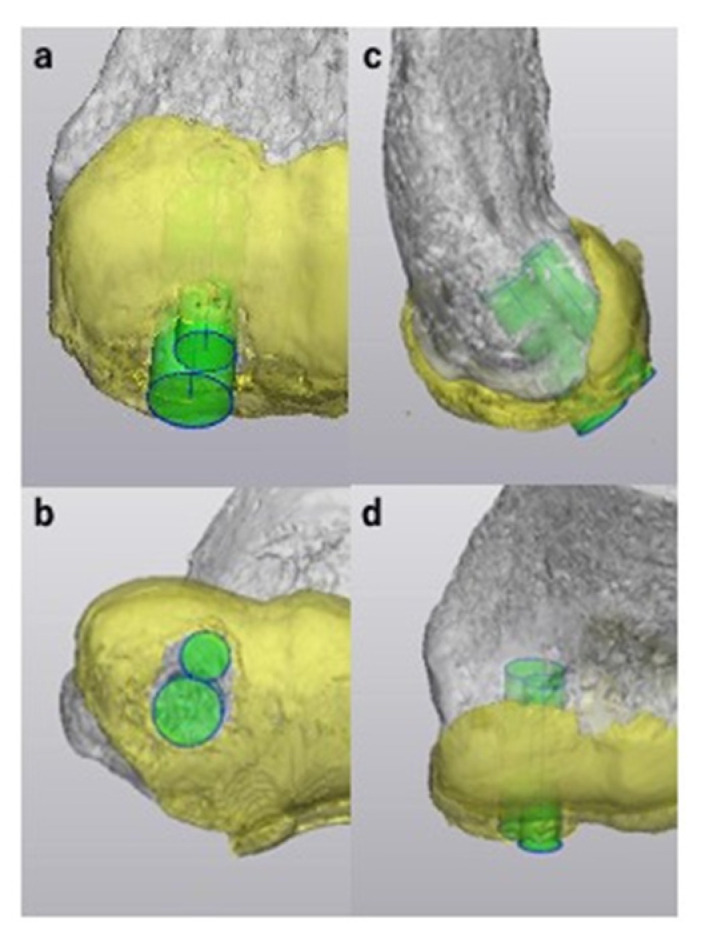 Figure 11