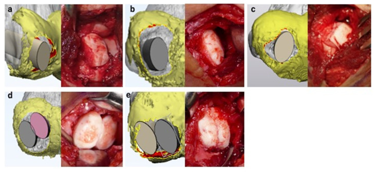 Figure 10