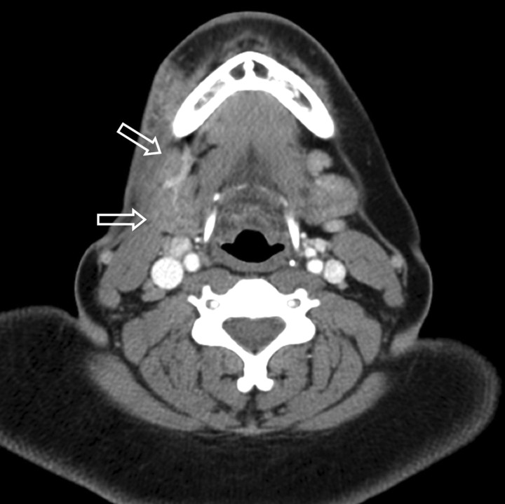 Fig 3.