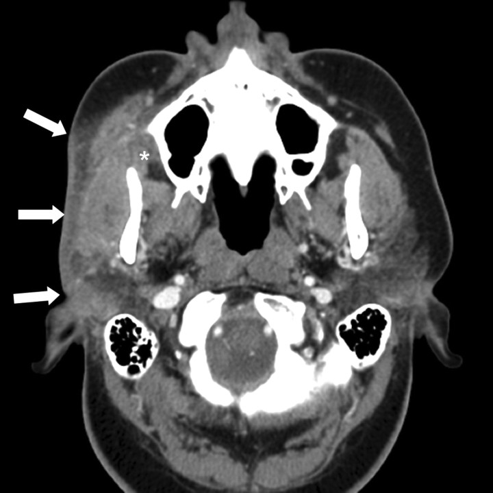 Fig 1.