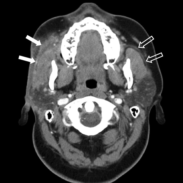 Fig 2.