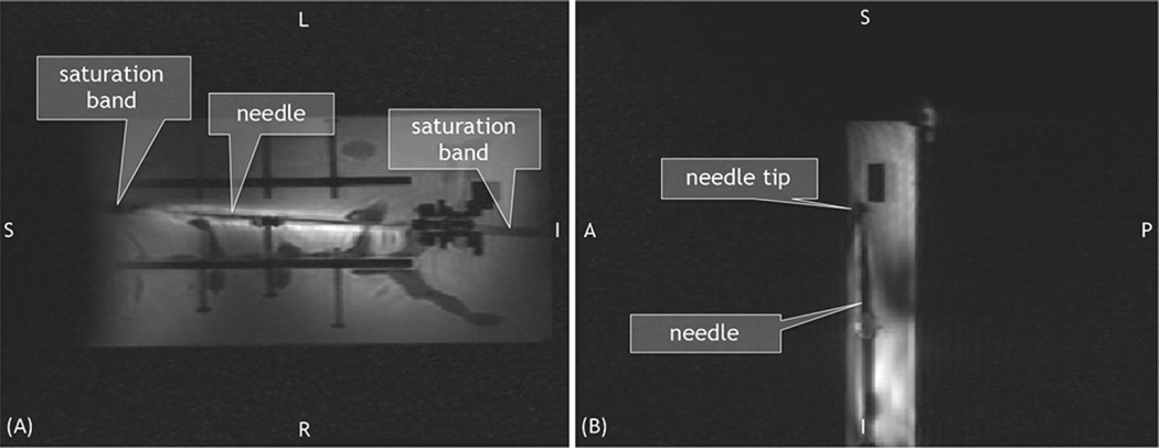 Fig. 14