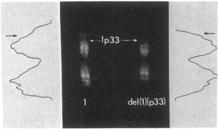 graphic file with name pnas00137-0028-a.jpg