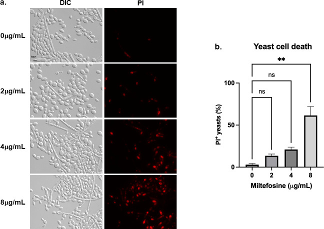 Yeast cells were treated with varying concentrations of miltefosine and visualized with DIC and PI staining to indicate cell death. Bar graph on the right quantifies the percentage of PI-positive (dead) cells.