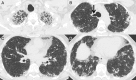 Figure 1 –