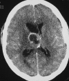Fig. 10