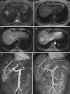 Fig. 13