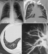 Fig. 4