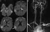 Fig. 9