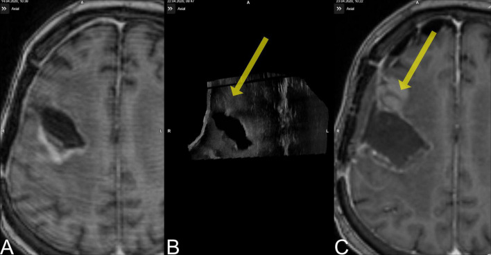 FIGURE 3