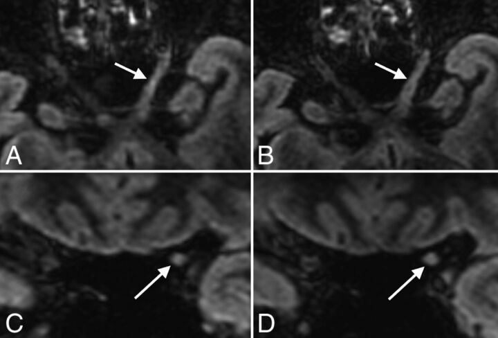 Fig 3.