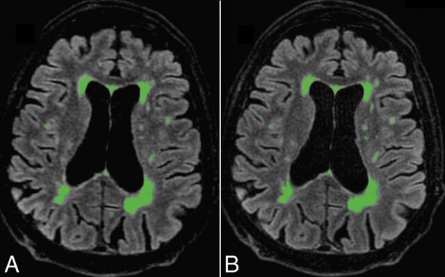 Fig 4.