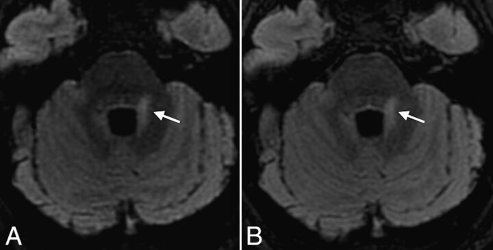 Fig 2.