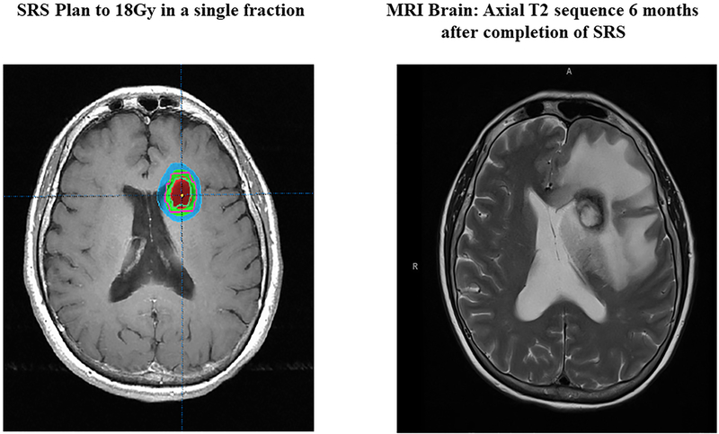 Figure 1: