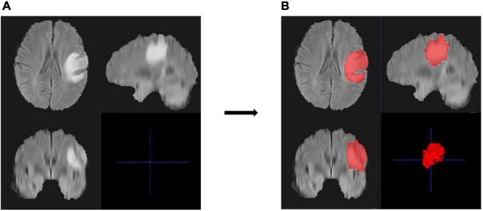 FIGURE 2