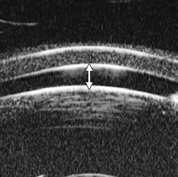 Fig. 19