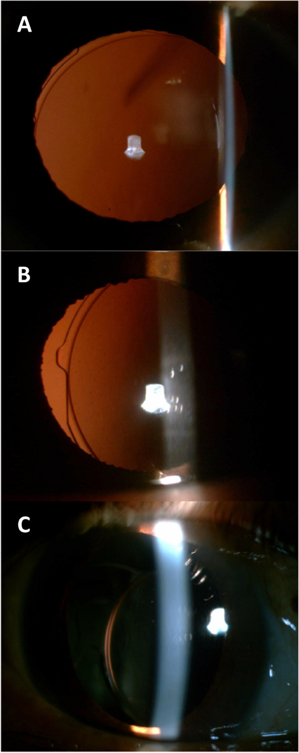 Fig. 3