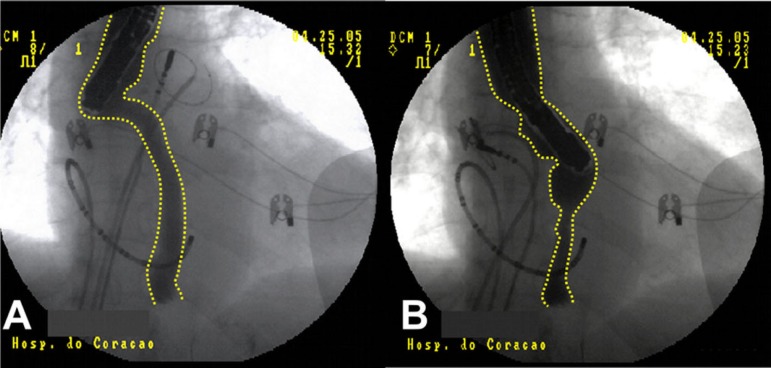 Fig. 6