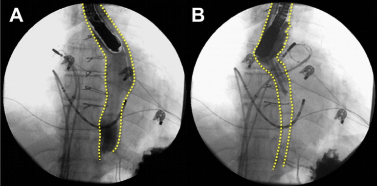 Fig. 4